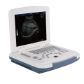 MT Medical china cheapest portable ultrasound machine